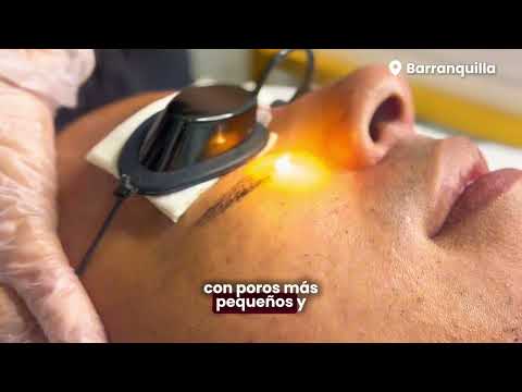 video FuAi8-3mS_A