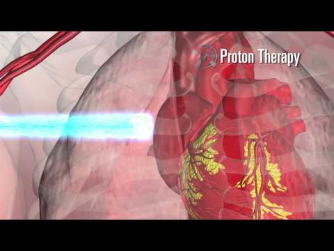 What is Proton Therapy?
