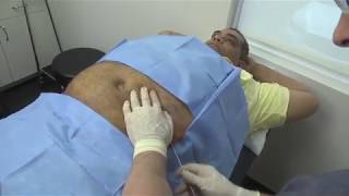 Video 3