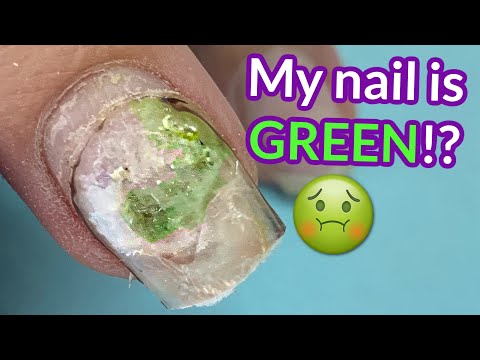 She Used Nail Glue And THIS is What Happened 🤢  | Melodysusie E-file Review
