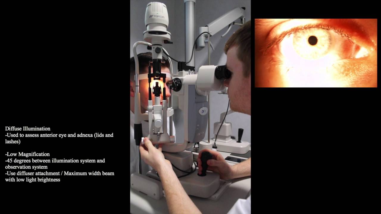 Slit Lamp: Diffuse Illumination and Patient Set Up