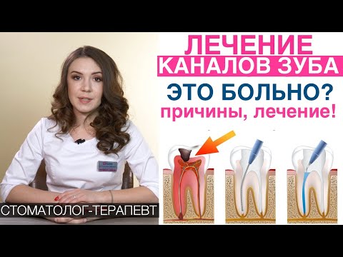 Лечение каналов зубов, пломбирование зубных каналов, лечение пульпита, удаление нерва из зуба!