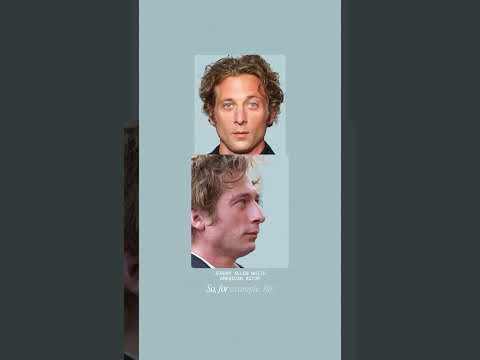 Your Side Profile Looks Different… Here’s Why