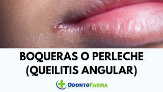 BOQUERAS O PERLECHE (QUEILITIS ANGULAR): La herida de las Comisuras Bucales