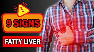 9 SIGNS WARNING FATTY LIVER ISSUES