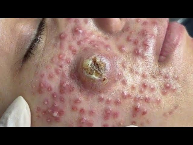 𝑨𝒄𝒉𝒊𝒆𝒗𝒆 𝑰𝒏𝒏𝒆𝒓 𝑷𝒆𝒂𝒄𝒆 𝑾𝒊𝒕𝒉 𝑻𝒉𝒆𝒔𝒆 𝑭𝒂𝒄𝒊𝒂𝒍 𝑪𝒍𝒆𝒂𝒏𝒔𝒊𝒏𝒈 𝑴𝒆𝒕𝒉𝒐𝒅𝒔 #4457339