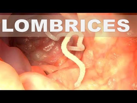 Gastric cancer early diagnosis