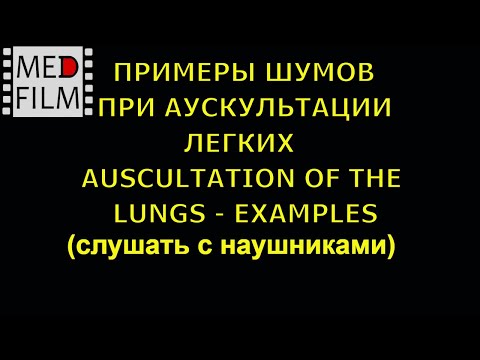 download lagu mp3 mp4 хрипы в легких слушать, download lagu хрипы в легких слушать gratis, unduh video klip Download хрипы в легких слушать Mp3 dan Mp4 320kbps Gratis