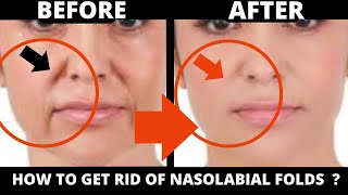 🛑 MARIONETTE LINES ? GET RID OF NASOLABIAL FOLDS WITH FACE YOGA, JOWLS, FOREHEAD, MOUTH | SUBTITLES