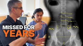 Powerlifter With Chronic Pain… The REAL Problem Was Hidden
