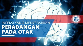 Toksoplasmosis, Infeksi yang Ditimbulkan oleh Parasite Toxoplasma Gondii Sebabkan Peradangan Otak