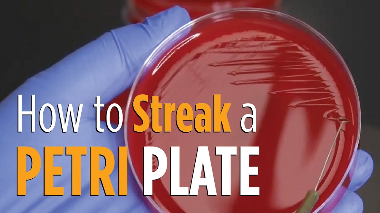 Four Quadrant Streak procedure - How to properly streak a Petri plate for isolated colonies