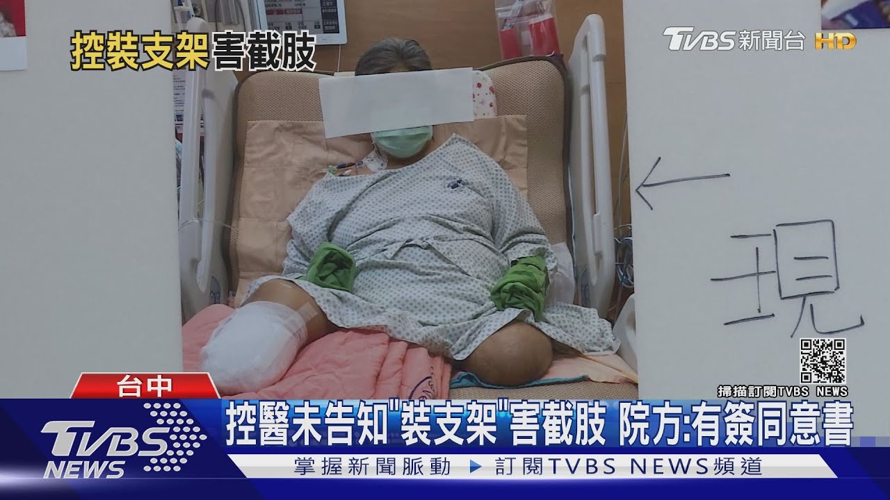 控醫未告知「裝支架」害截肢 院方:有簽同意書