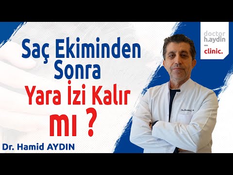 Saç Ekiminden Sonra Yara İzi Kalır mı? - Dr. Hamid AYDIN
