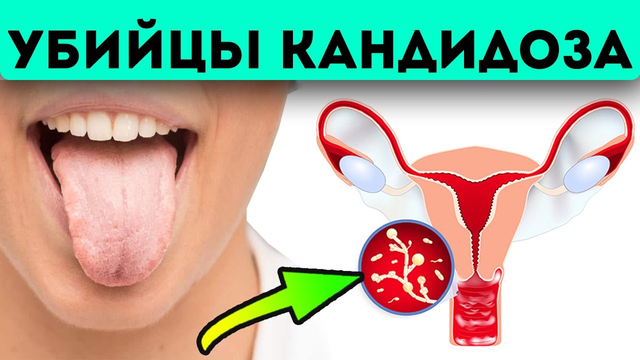 Стыдно спросить Старые врачи пользовались этими секретами в лечении кандидоза