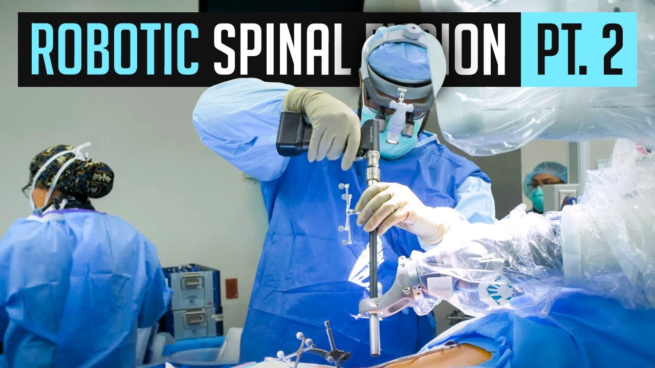 Robotic Spinal Fusion | Part 2