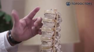 Microdiscectomía: cirugía para la hernia de disco lumbar