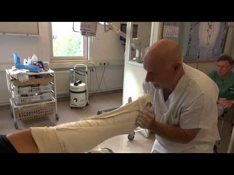 comment soigner une rupture partielle du tendon d achille
