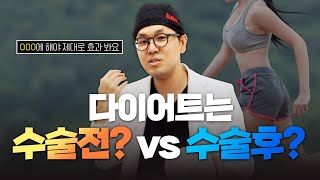 다이어트는 수술전? 수술후? 언제 해야 효과가 좋을까?