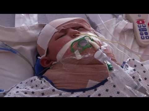 Koślawego masaż stóp z nastolatkiem Koślawego o jeziorach aptecznych