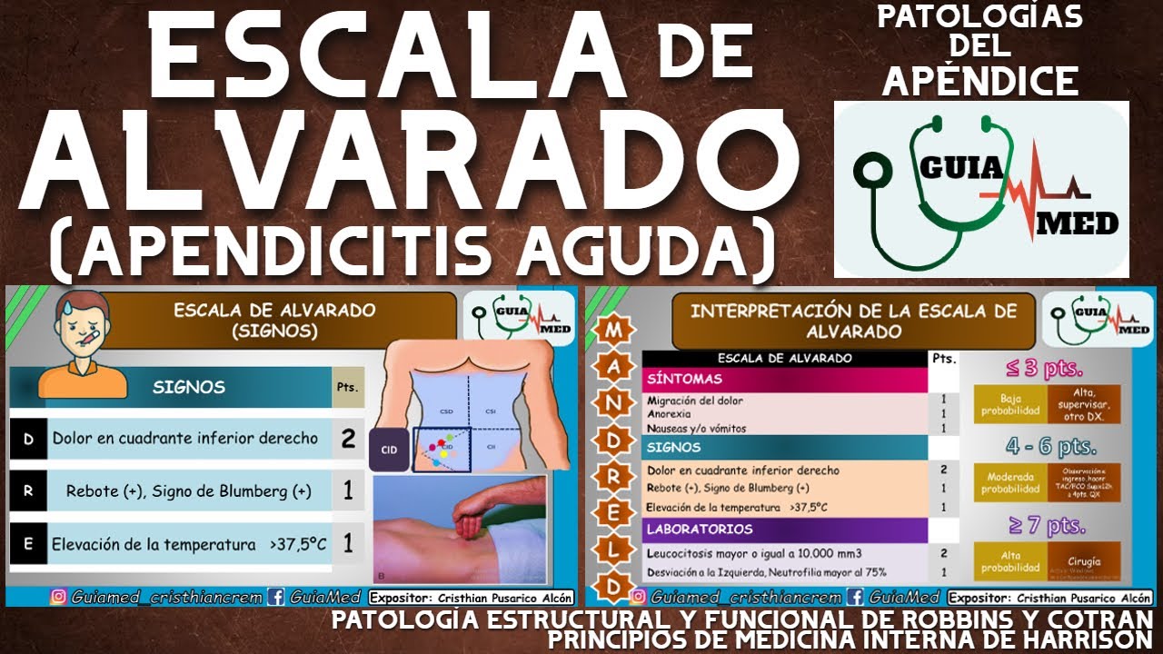 ESCALA DE ALVARADO PARA APENDICITIS | GuiaMed