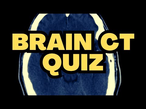Brain CT Quiz