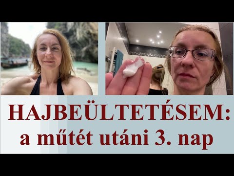ha porc van a péniszben