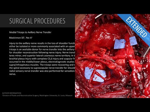 Medial Triceps to Axillary Nerve Transfer - Extended (Feat. Dr. Mackinnon)