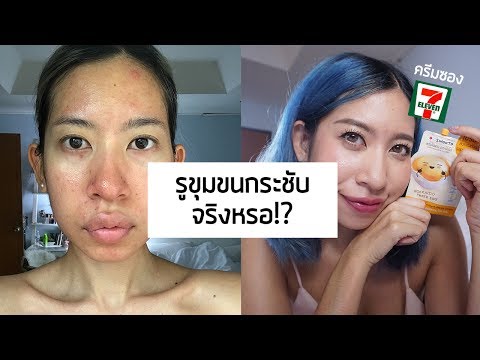 ครีมน้ำมันสำหรับกลาก 1 VC ยาหม่องกับโรคสะเก็ดเงิน