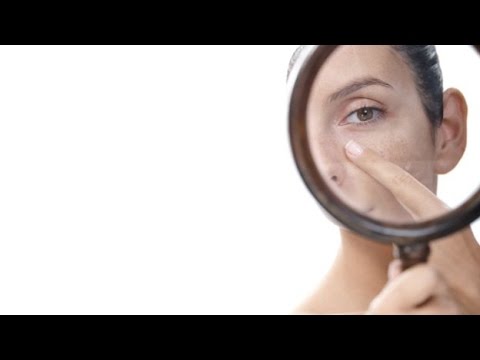 Combattere contro pigmentazione su una faccia Indiano di crema del corpo decolorazione estiva