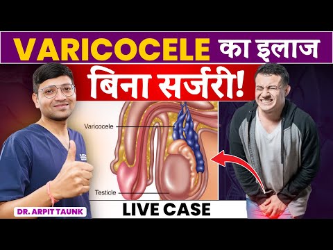 How is Varicocele treated? Treatment Without Surgery Varicocele Embolization Live Case