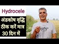 हाइड्रोसिल अंडकोष की वृद्धि ठीक होगी �