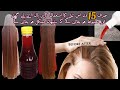 Magic Hair Oil For 4x Faster Hair Growth & Dandruff | 15 Days Challenge 💯| بال اتنے لمبے کہ سب حیران