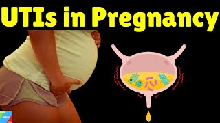 Urinary Tract Infections (UTIs) during Pregnancy: Symptoms, Causes, Treatment & Prevention