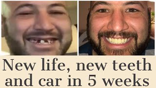 New life, new teeth and 10 people baptized in 5 weeks! :) WOW - SEE THIS