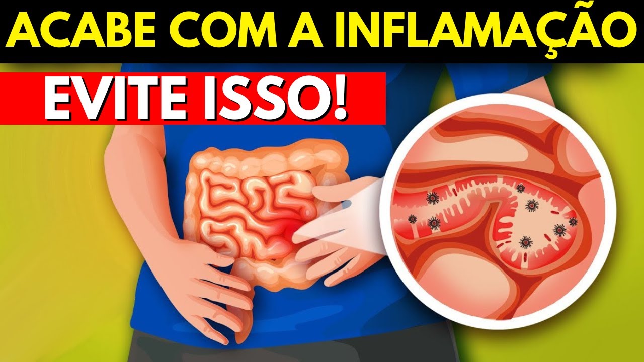 Os 5 principais alimentos que causam inflamação no intestino