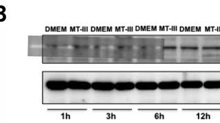 Download lagu 2B93904146415E8ABCB711746CA709#1 mp3