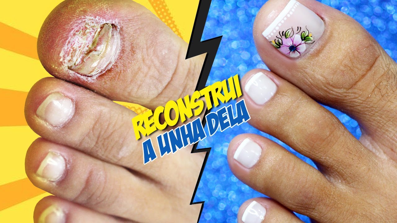 COMO FAZER UNHA DO PÉ (CHOCANTE)