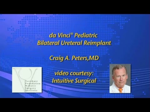 Pediatric Bilateral Ureteral Reimplant