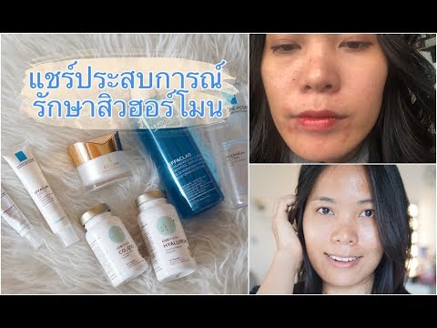 Krym โคลนโรคสะเก็ดเงิน สเปรย์จากหนังศีรษะโรคสะเก็ดเงิน
