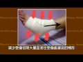 肌肉拉傷挫傷疼痛難耐？復健師5招護傷口
