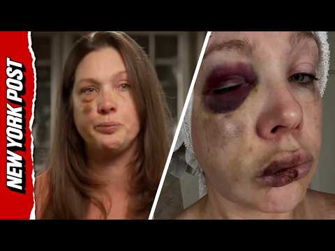 Single mom viciously beaten in Cincinnati brawl breaks down: 'I am not okay'