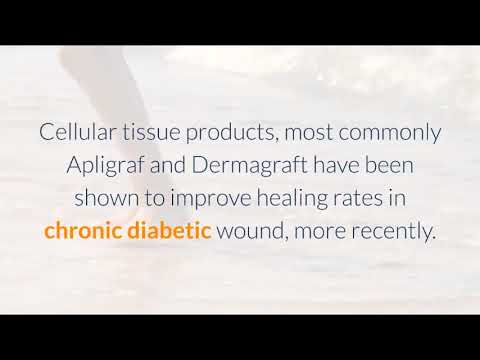 Amniotic Membranes for Diabetic Foot Ulcers - Center for Foot Care
