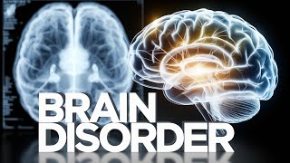 The Rare Brain Disorder That Changed RFK Jr.'s Voice Forever!