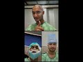 Hair Transplant journey of Famous Actor / Drama Artist Zuhab Khan | Alkhaleej Clinics
