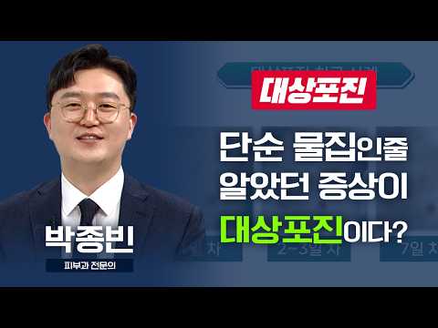 영상 썸네일