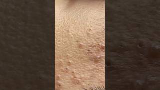 This is my gift to everyone 🤣. It's unbelievable that I have over 1000 videos #shortvideo #skincare