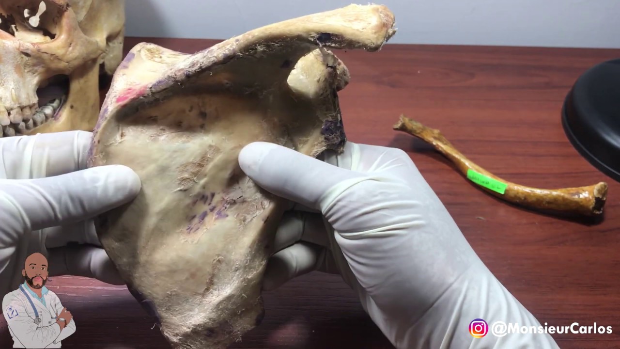 Anatomía - PRÁCTICA DE ESCAPULA (Caras, Bordes, Músculos)