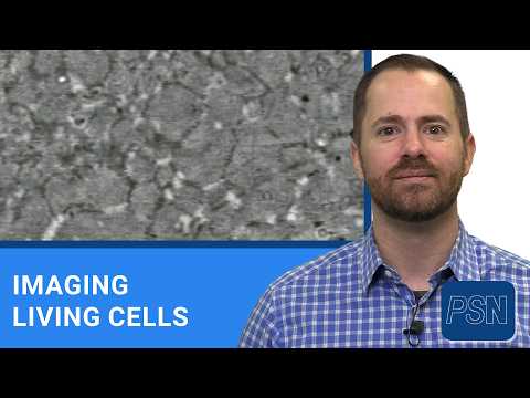 Stanford Microscope Could Change How We View Living Cells | | Videos ...