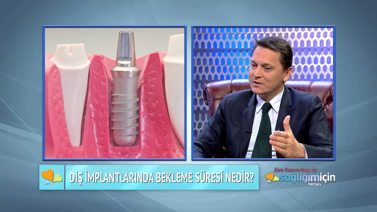 Diş İmplantları ve Eksik Dişlerin Tedavisi